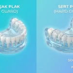 yumuşak plak mi sert plak mi diş sıkma şiddetine göre zırhınızı seçin