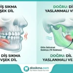 dil-pozisyonunun-onemi-ve-dis-sikma-engelleme